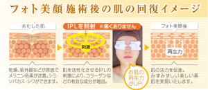 フォト美顔